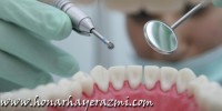 دندان درد و درمان طبیعی آن